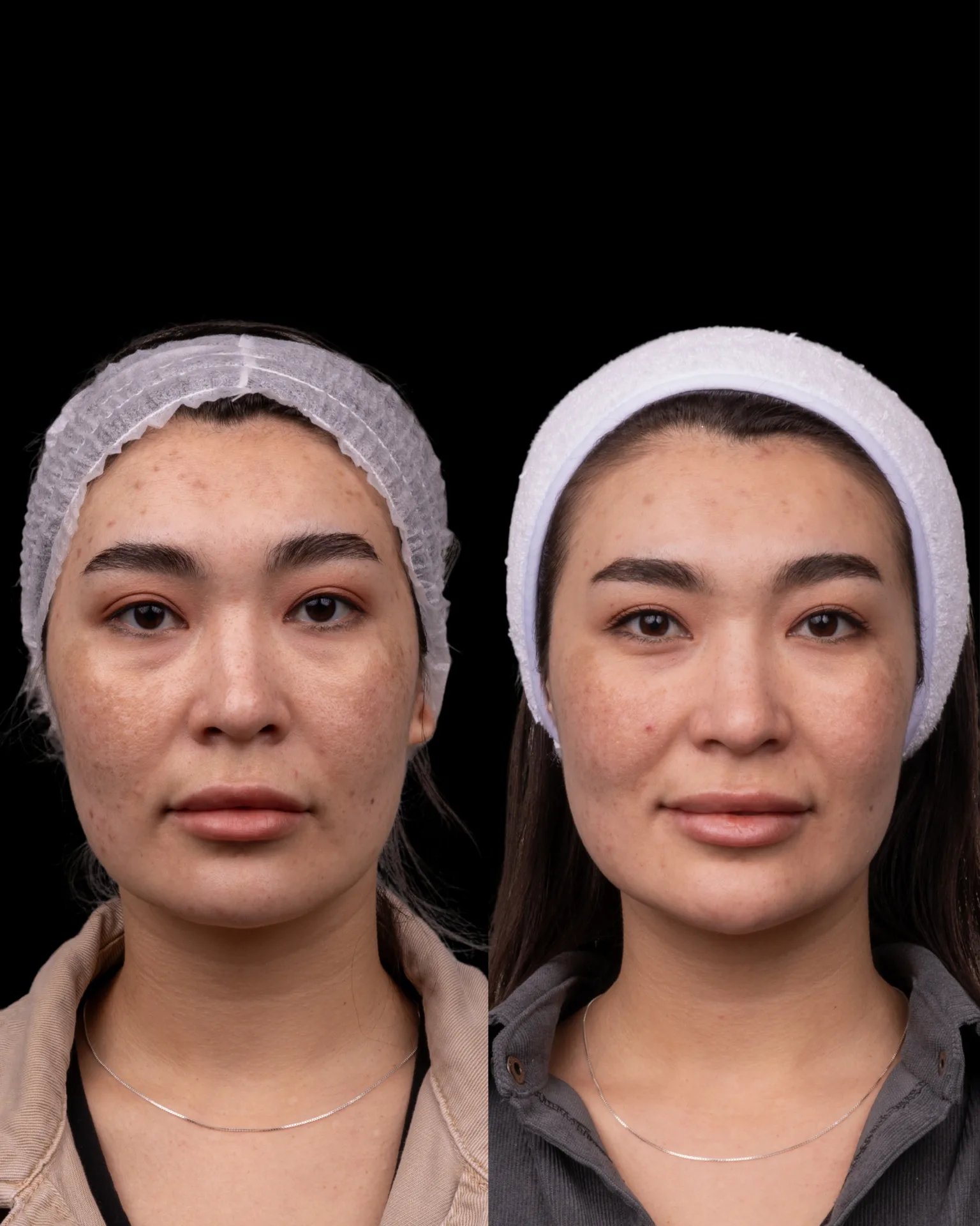 Result — treatment result