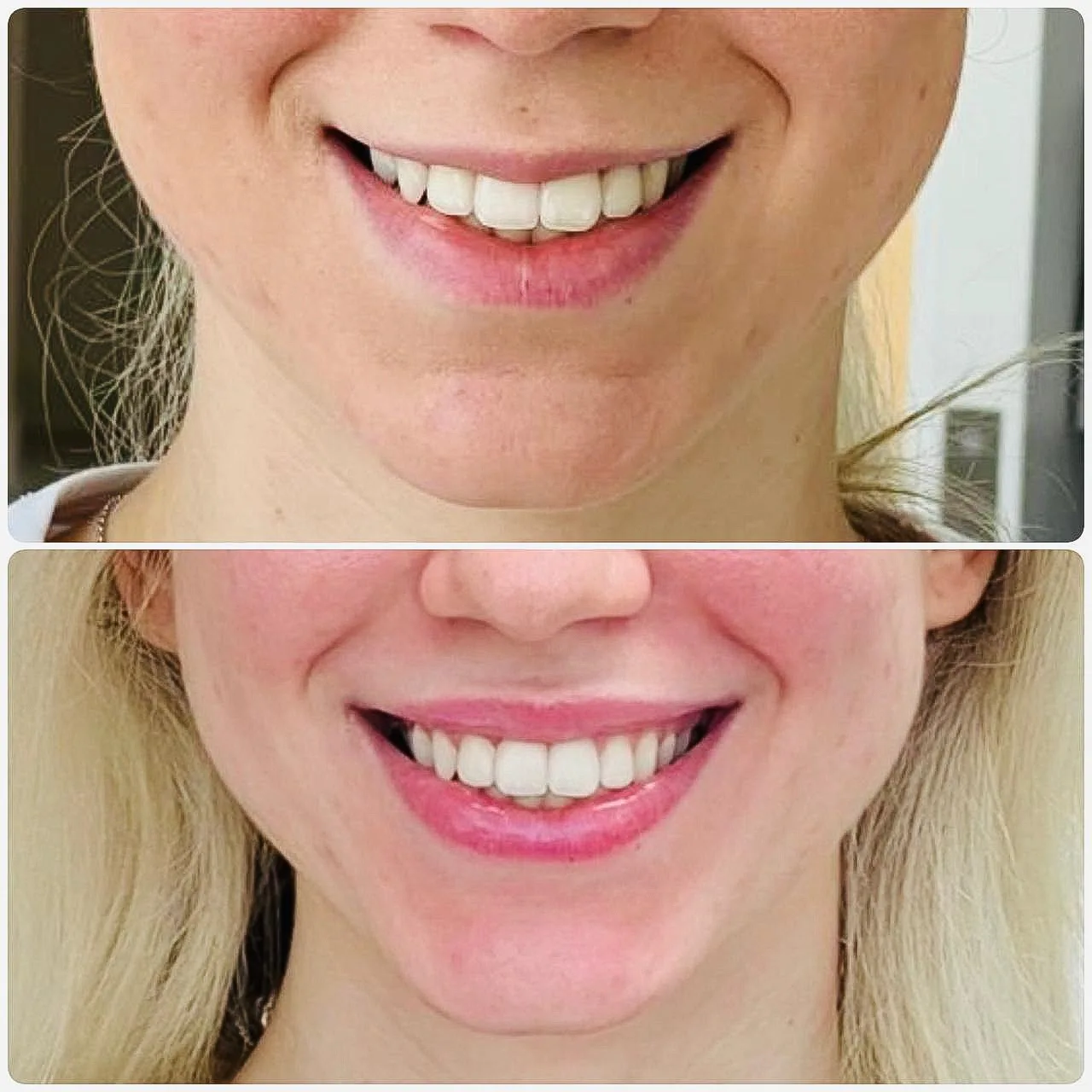 Befoure and After