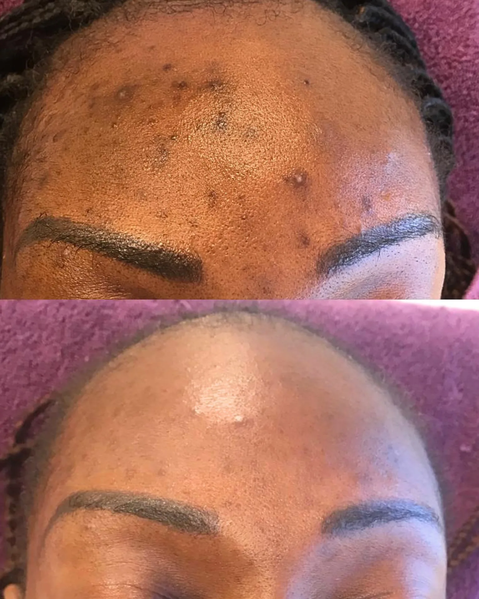 Befoure and After