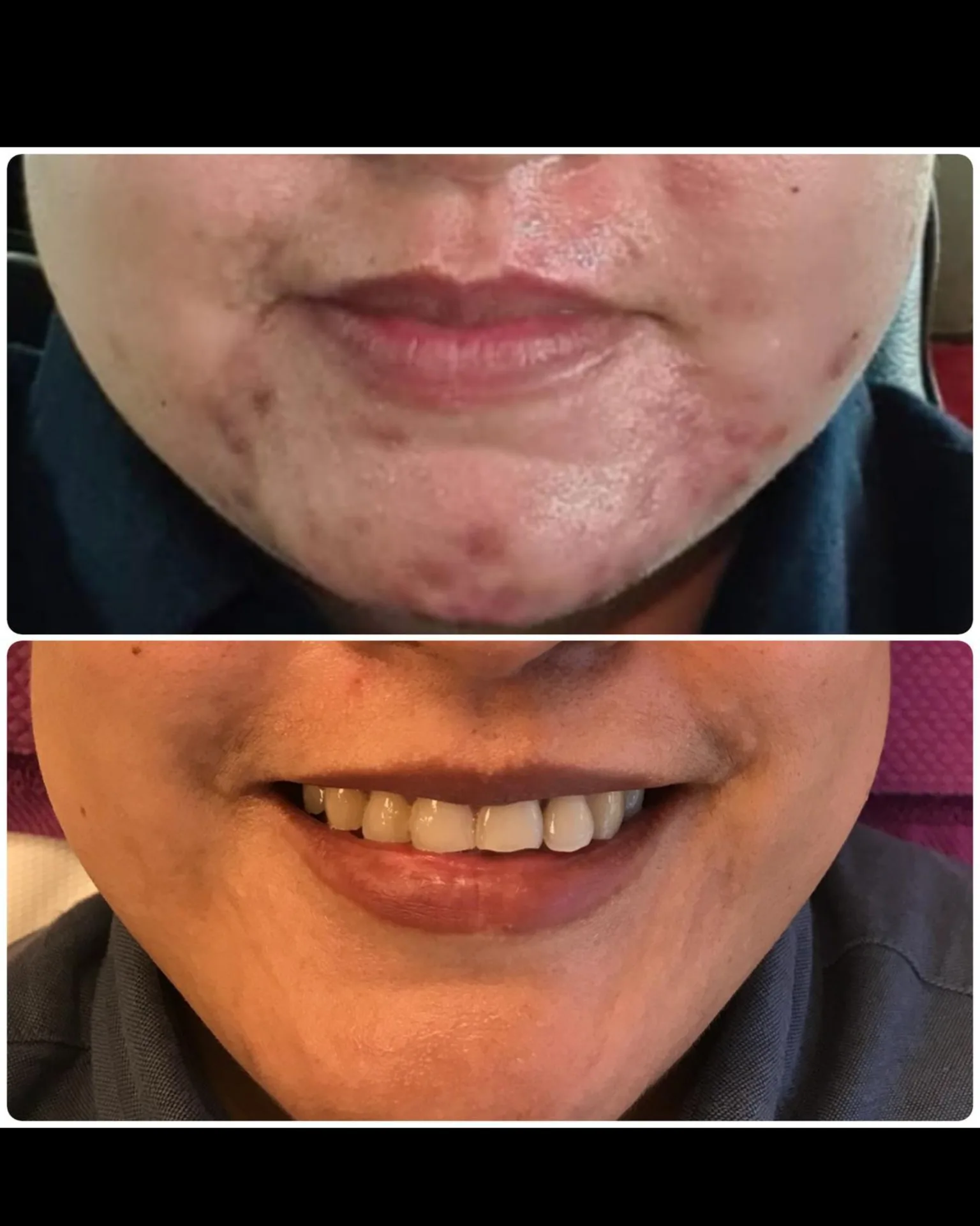 Befoure and After