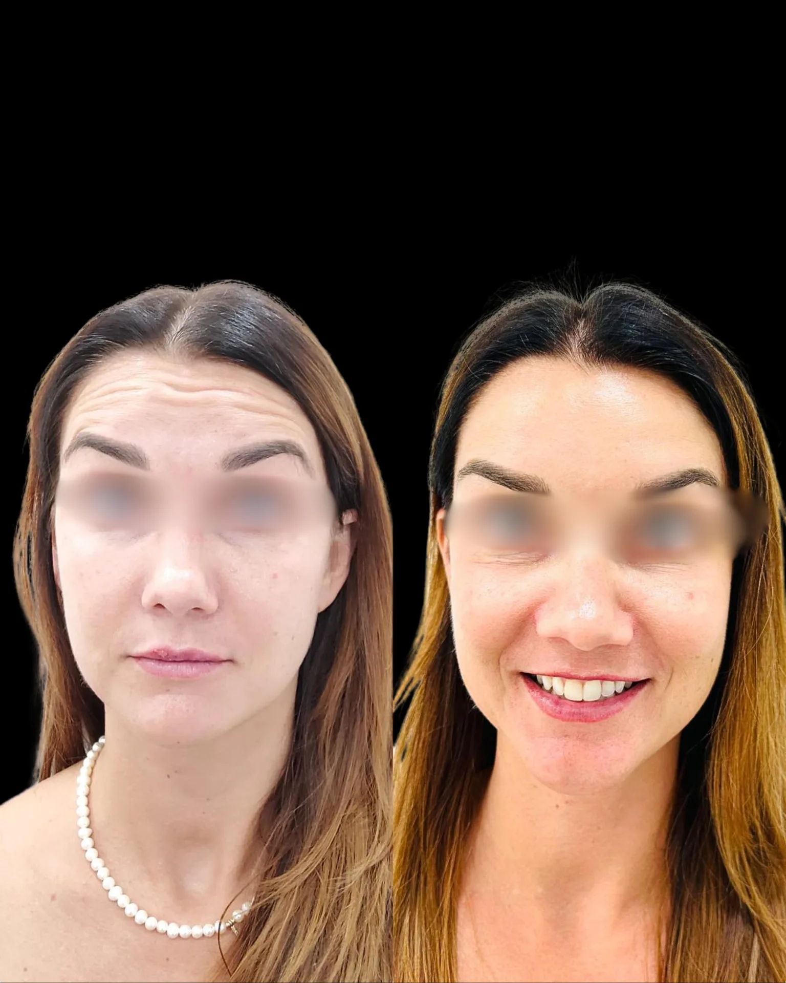 Result — treatment result