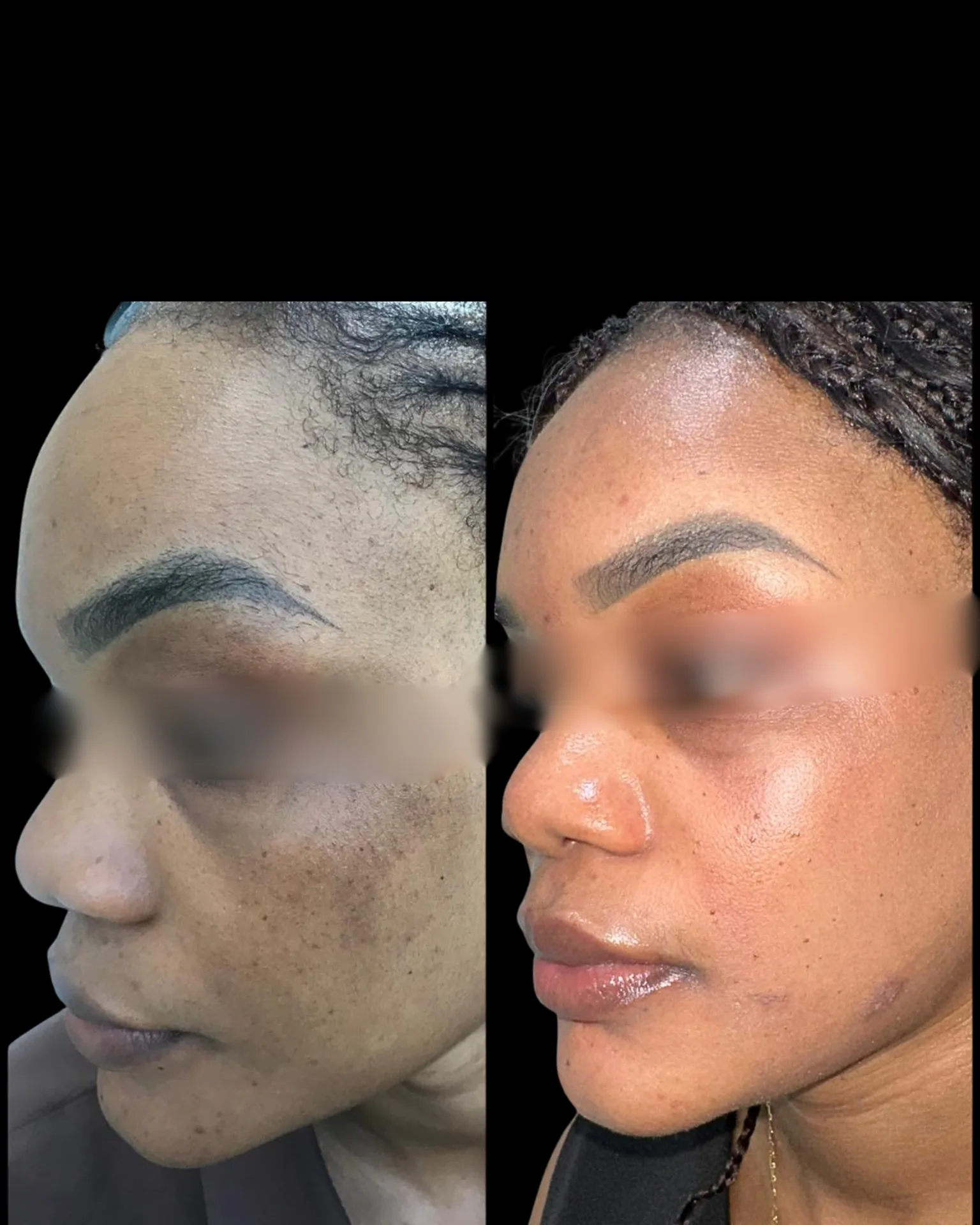Befoure and After