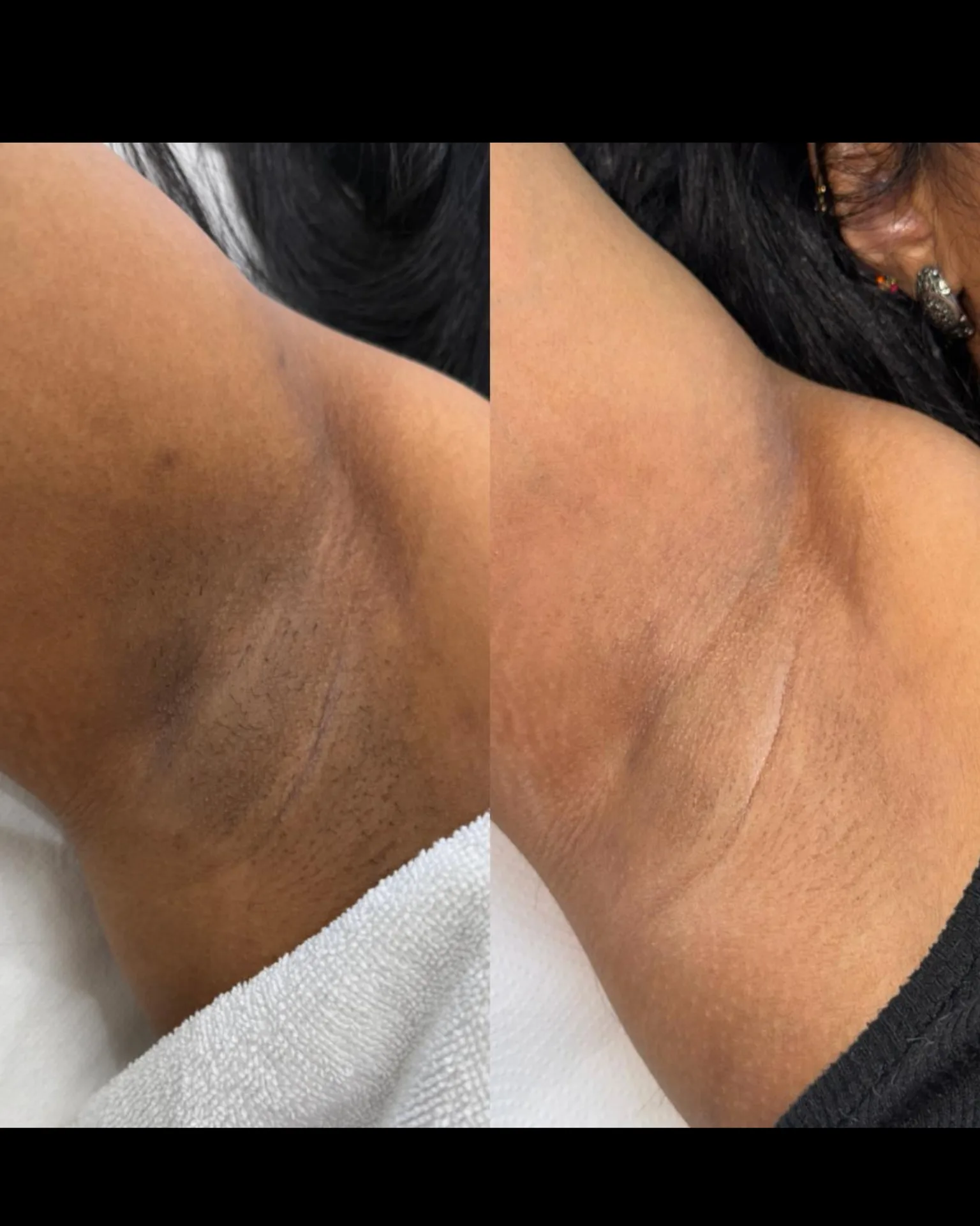 Result — treatment result