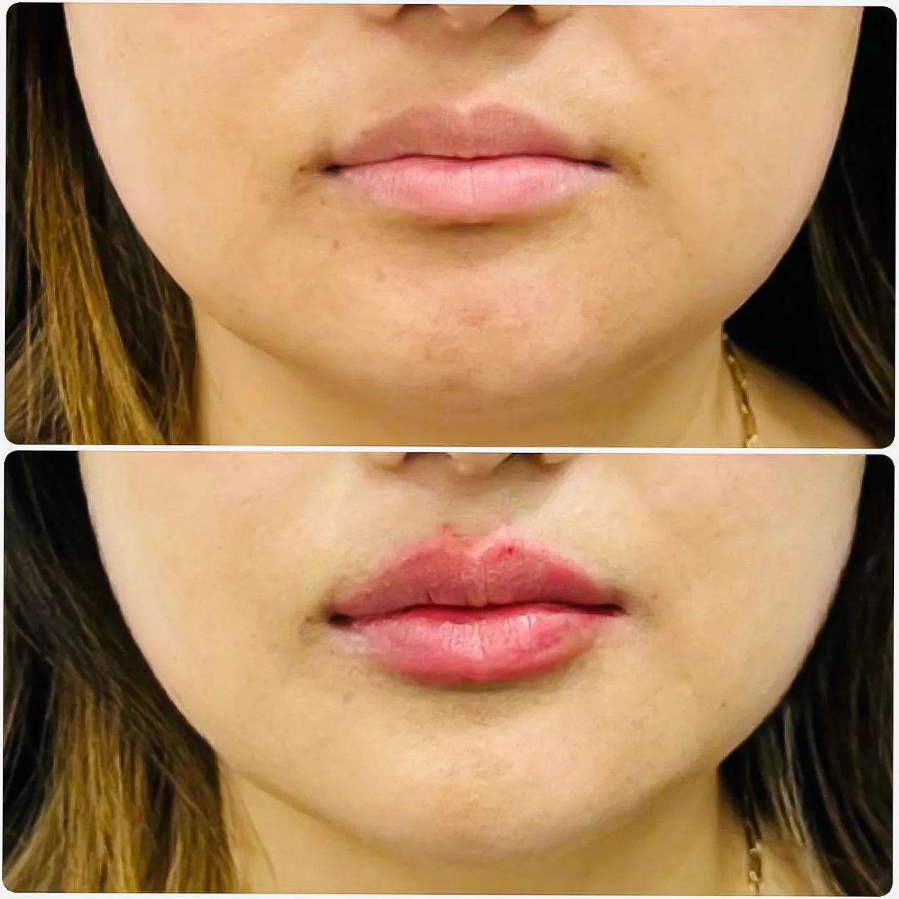 Befoure and After
