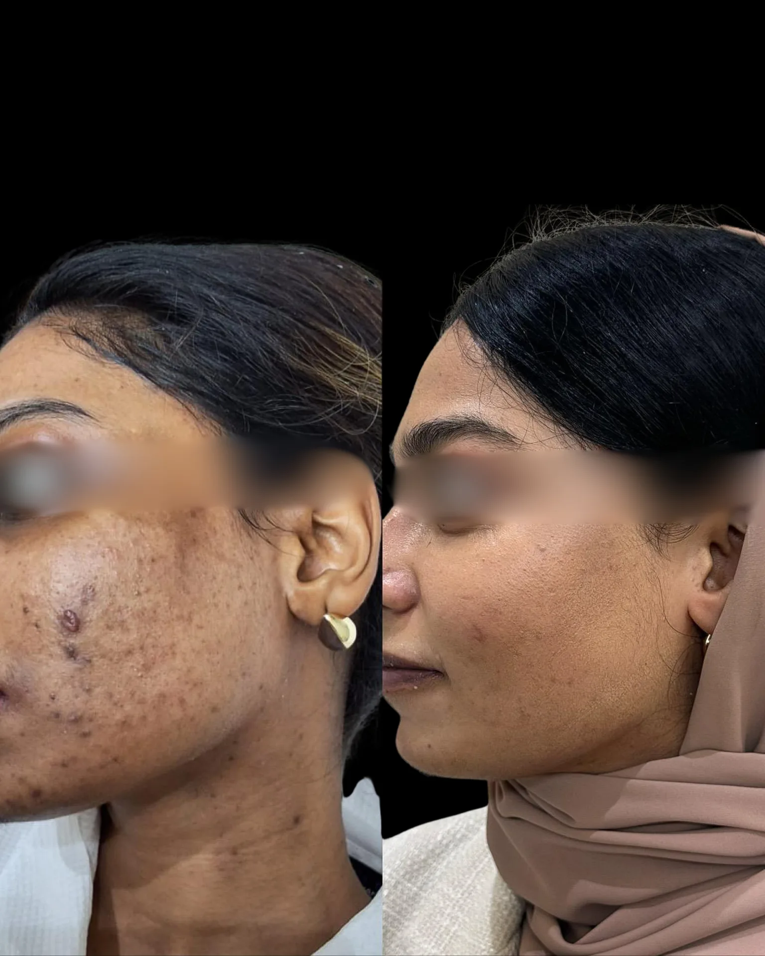 Result — treatment result