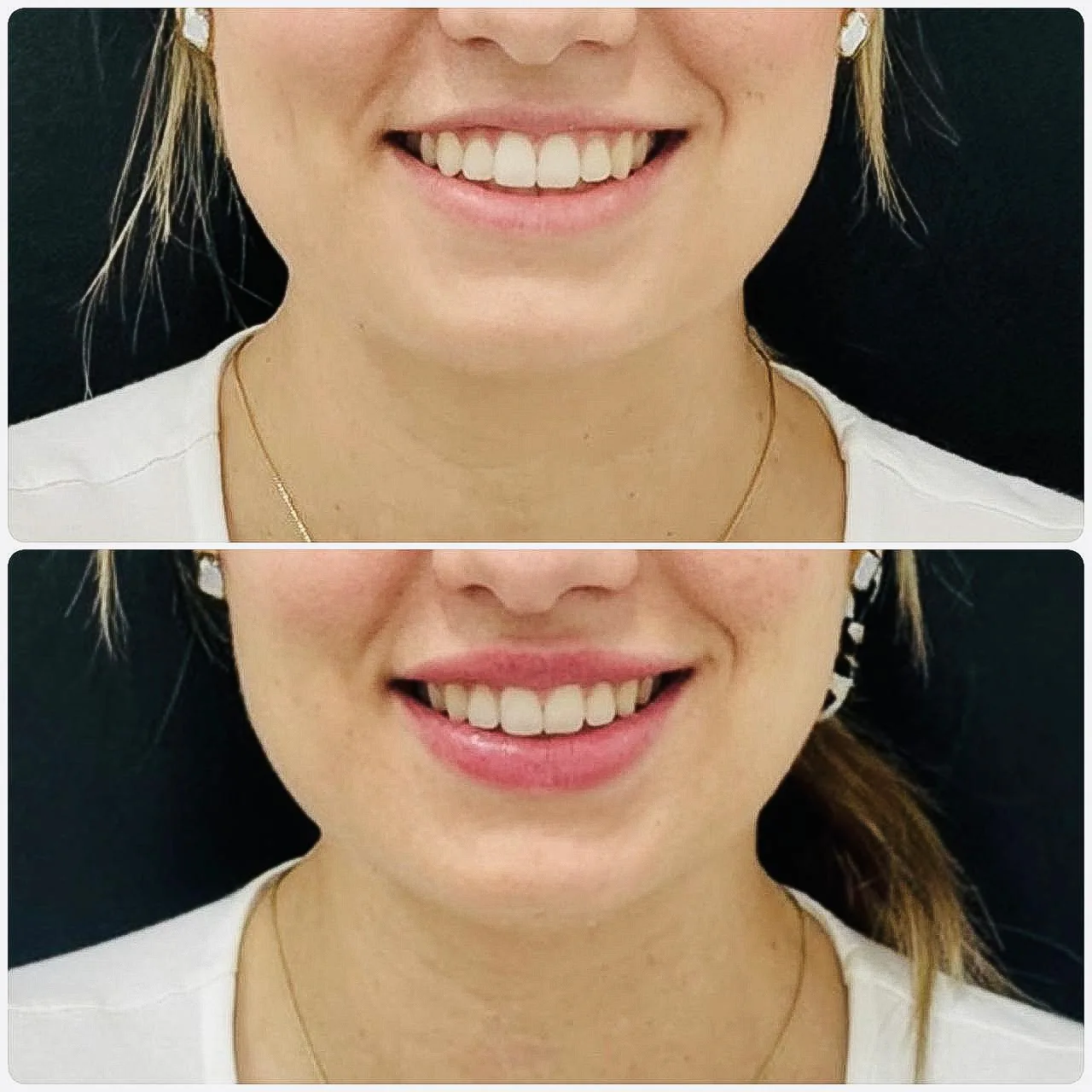Befoure and After