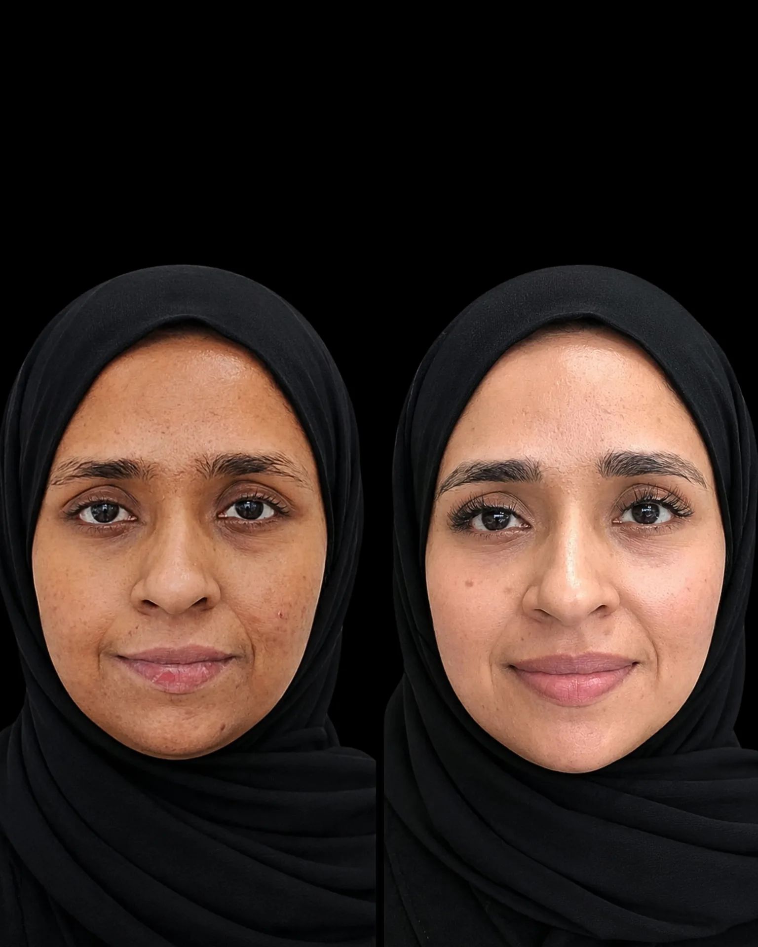 Result — treatment result