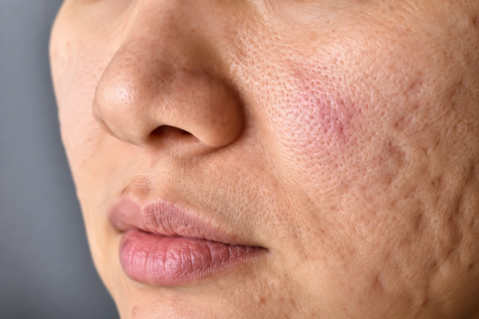 What Are The Symptoms?