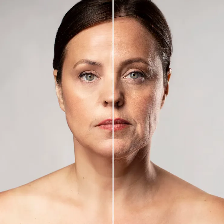 MAXXI PRP Treatment in Dubai