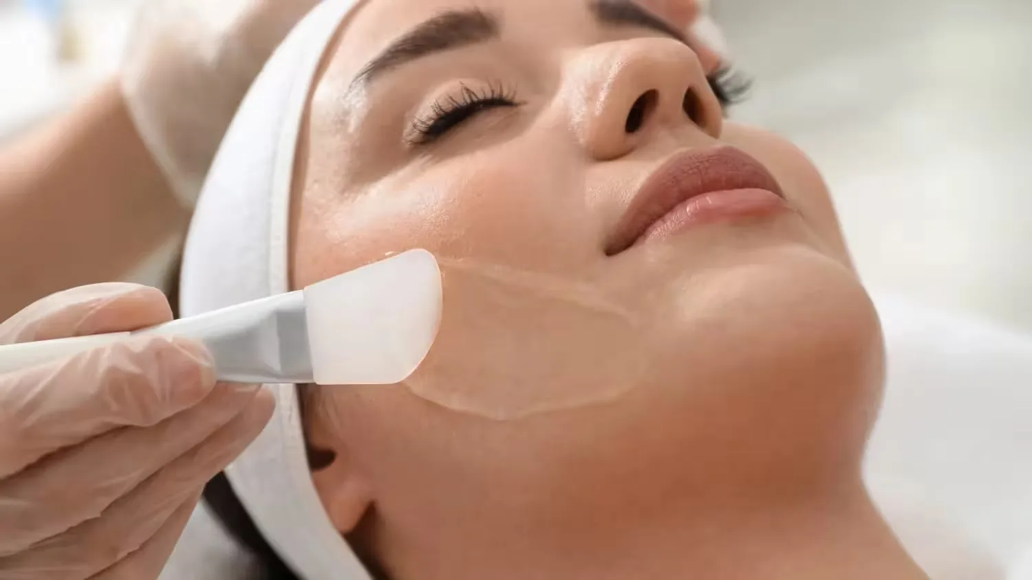 Chemical Peels: Transform Your Skin with Modern Aestheticss