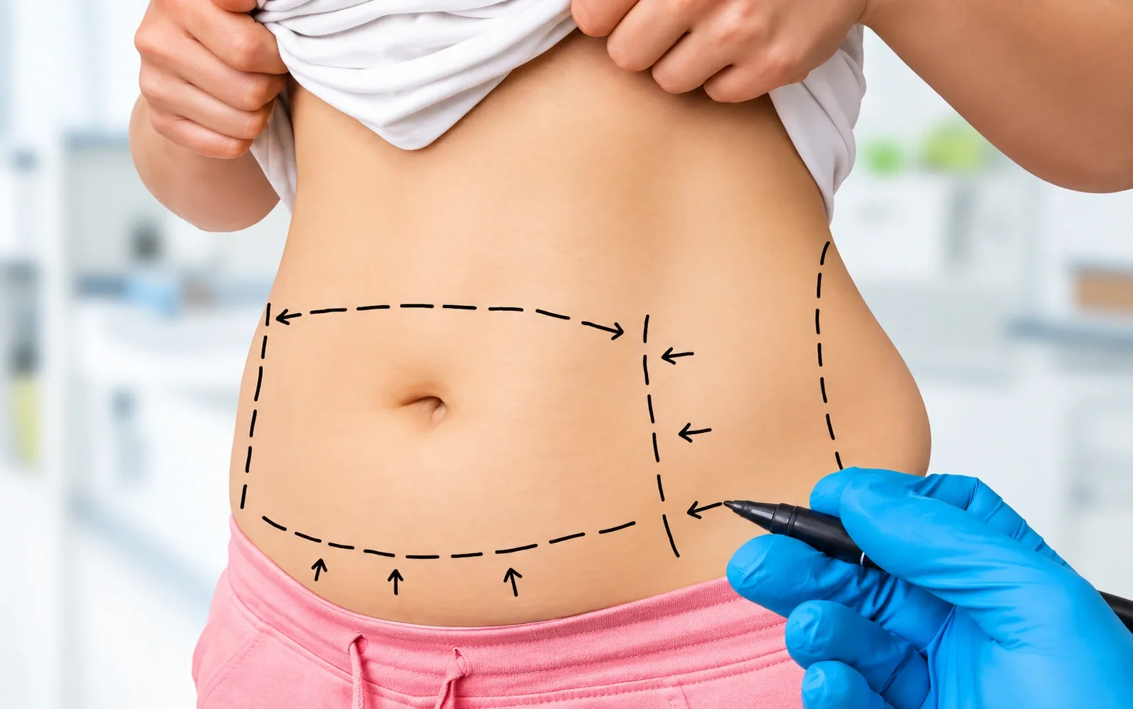 Procedure Overview