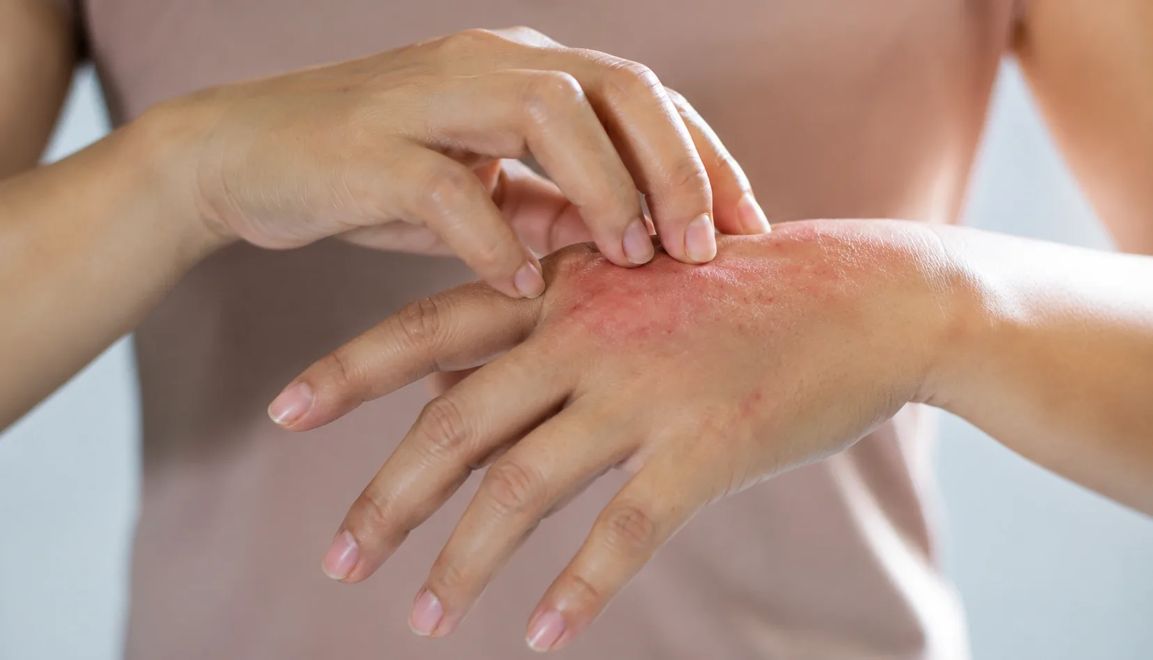 What Are The Symptoms?