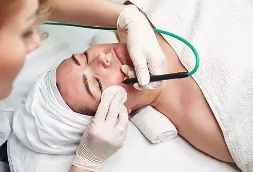 Electrocautery: A Complete Guide to Safe and Effective Treatment