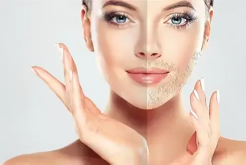 Hirsutism 101: The Hidden Hormonal Imbalance You Shouldn’t Ignore