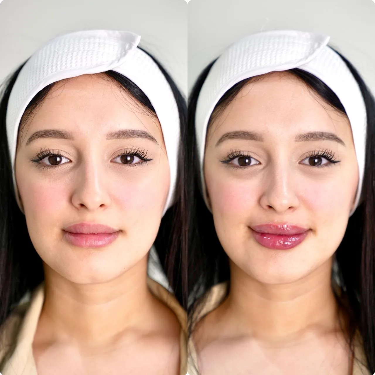 Result — treatment result