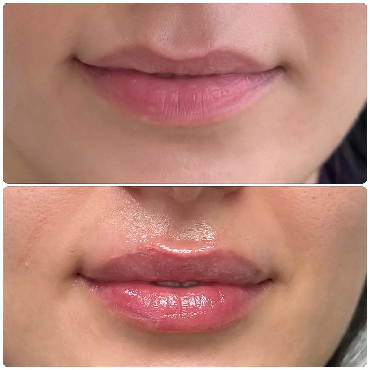 Befoure and After