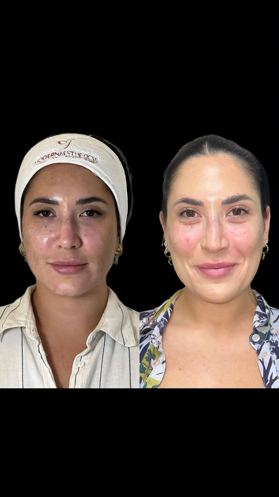 Result — treatment result
