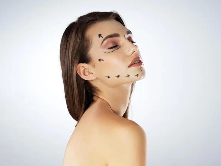 Jawline Fillers in Dubai: Sculpted Contours Without Surgery