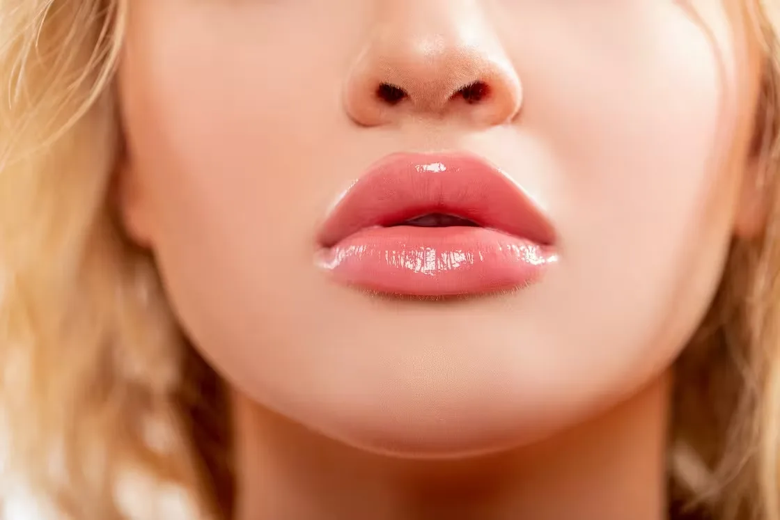 lip-fillers-and-lip-treatment-benefits