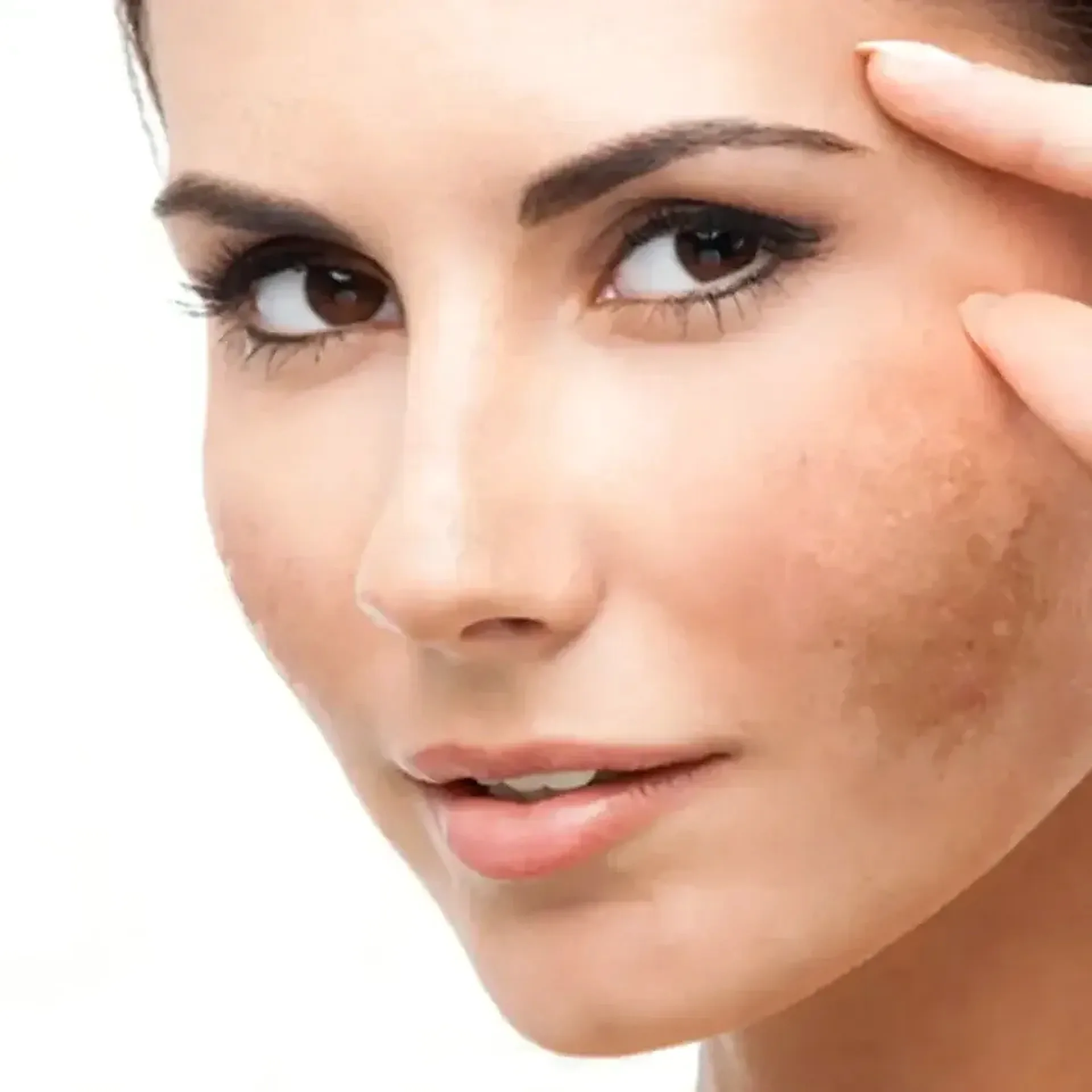 What causes melasma?