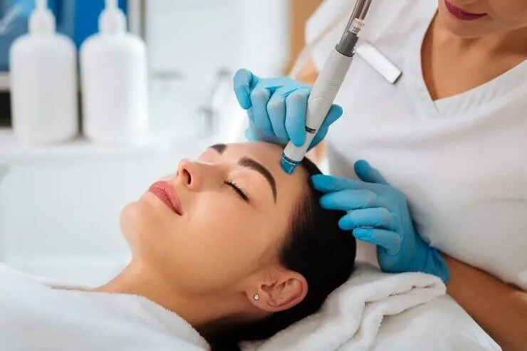 Microneedling treatment