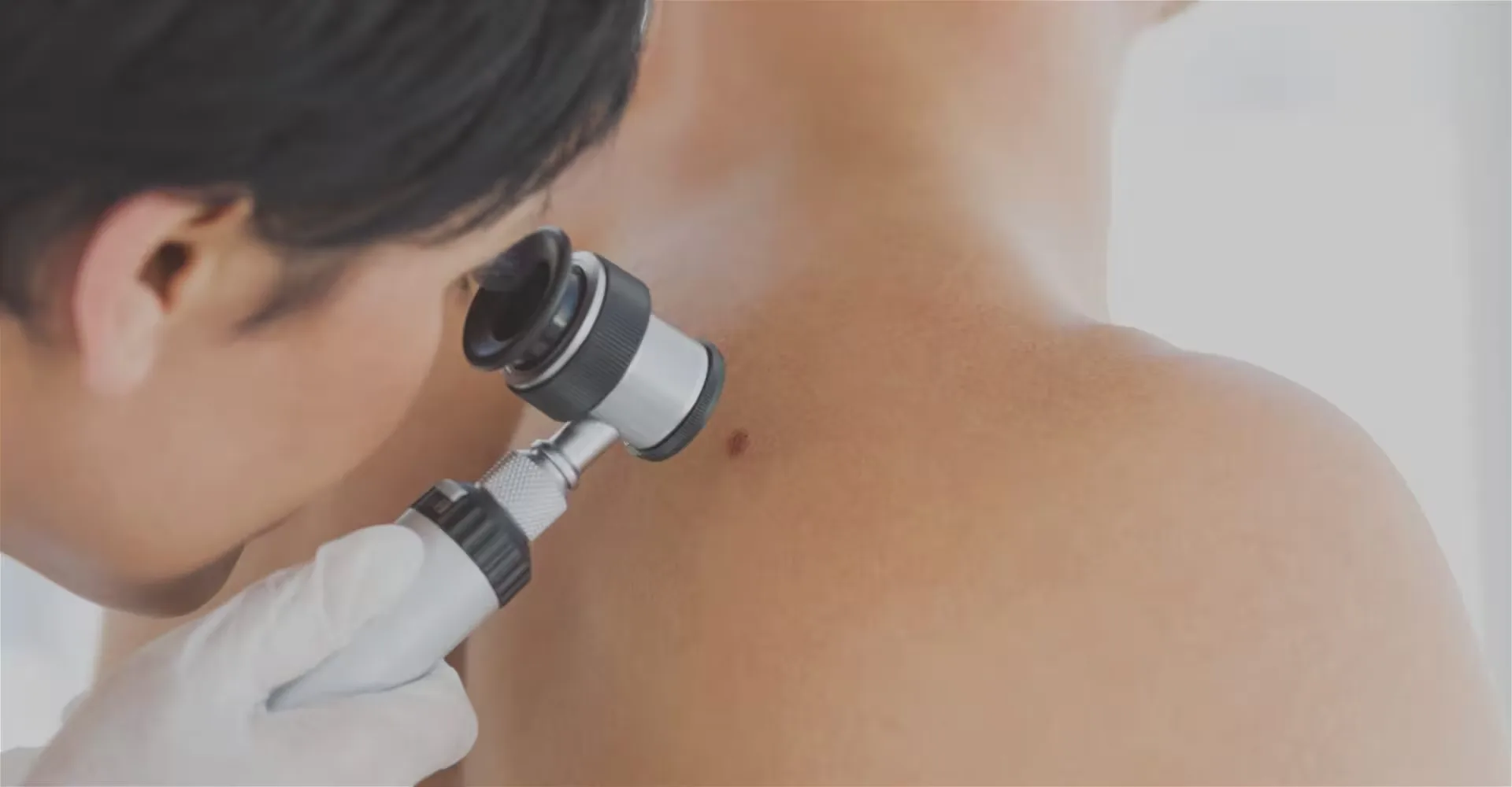 mole-mapping-treatment