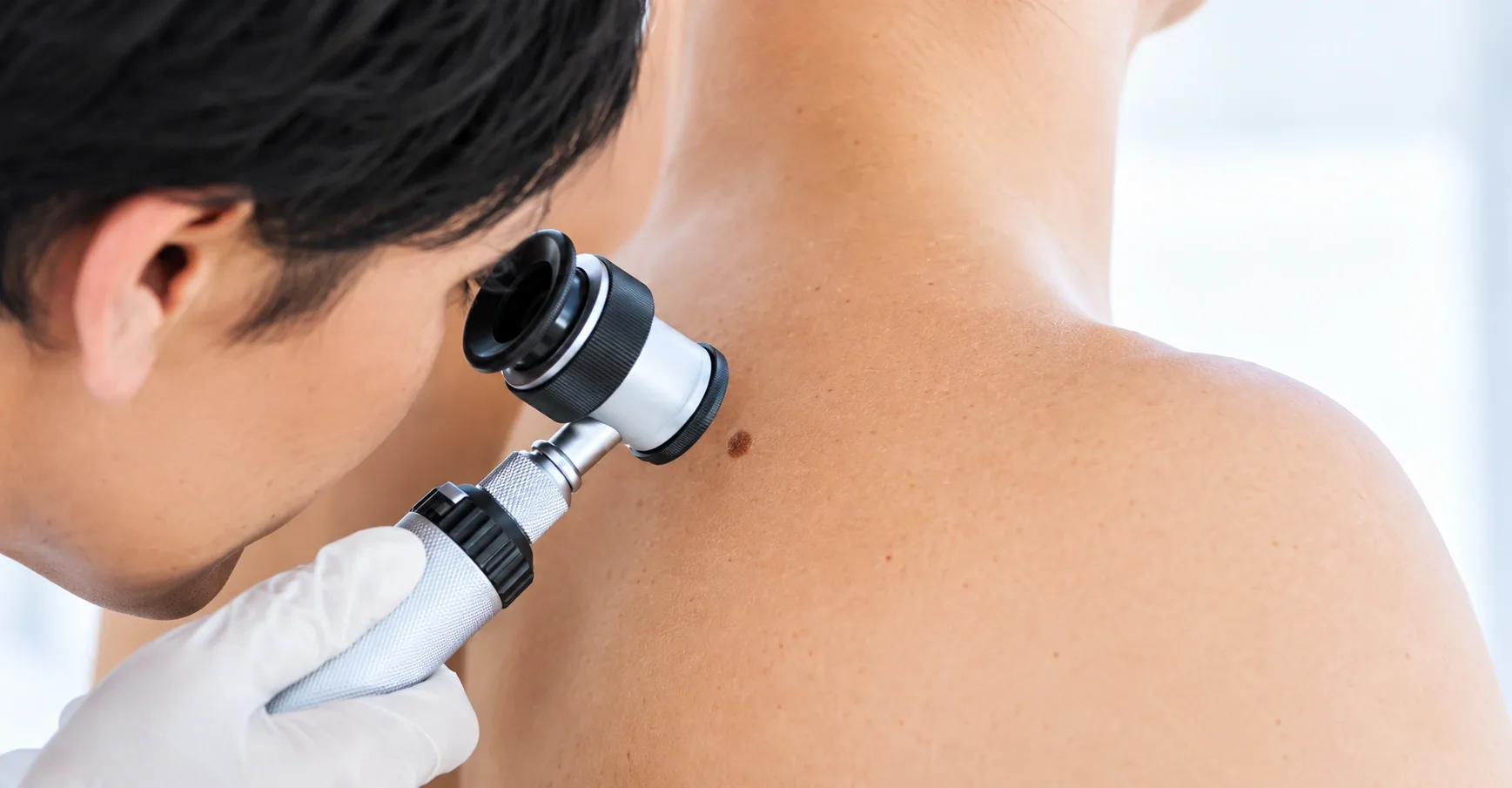 Skin Cancer Screening Dubai