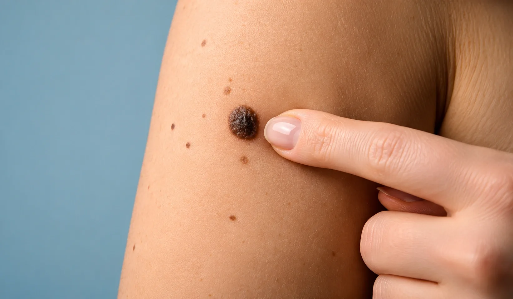 Technology Used in Mole Mapping