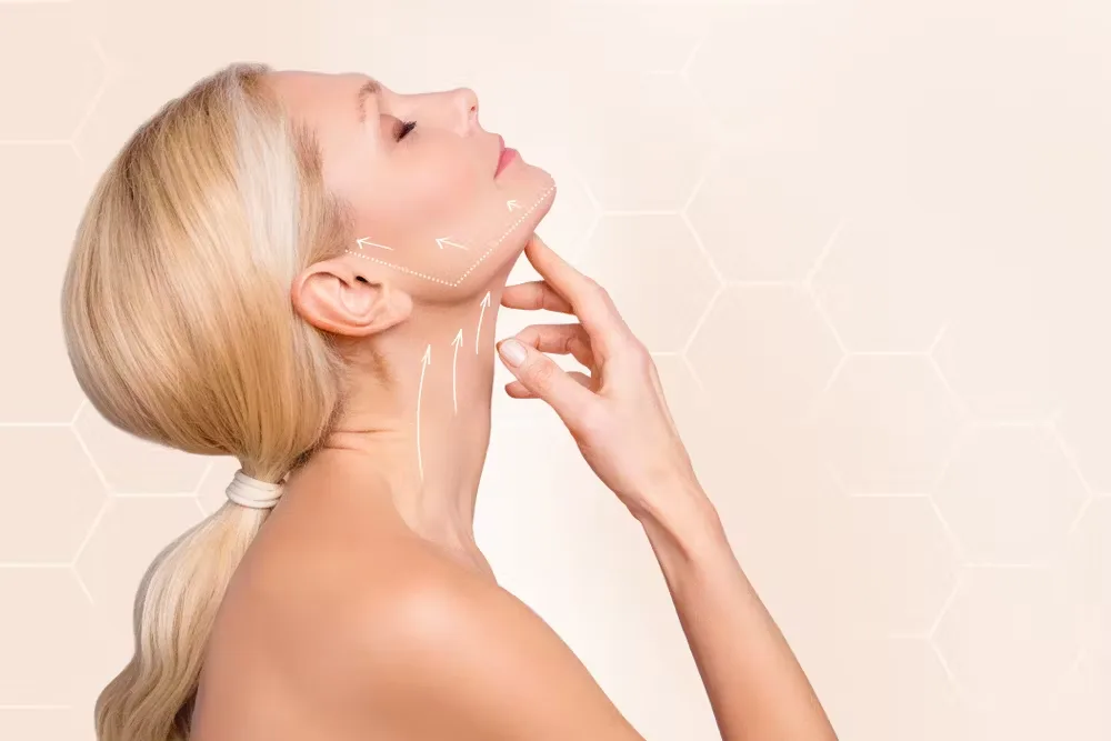 Nefertiti Neck Lift in Dubai: The Secret to a Sculpted Jawline and Youthful Neck