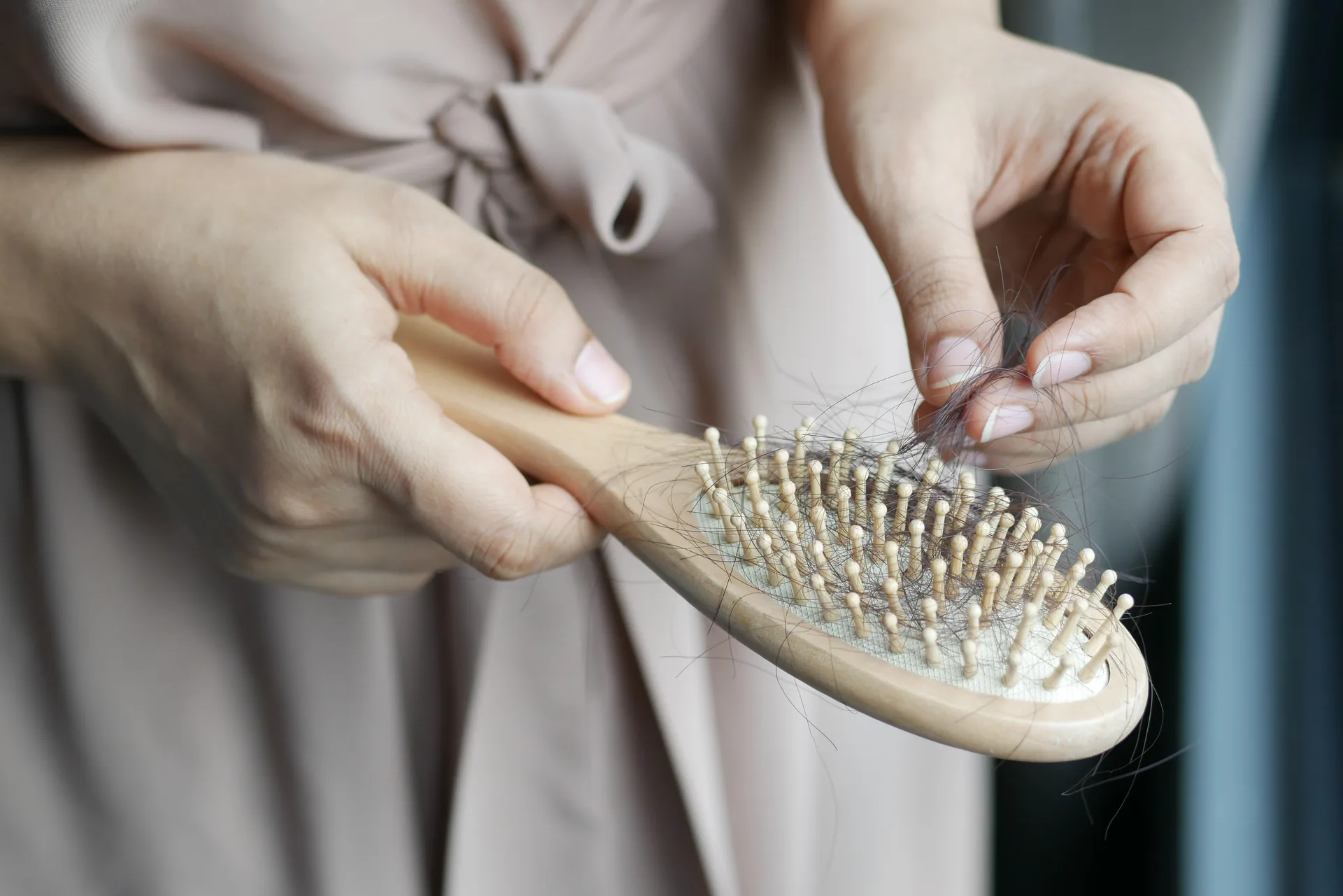 Hair loss