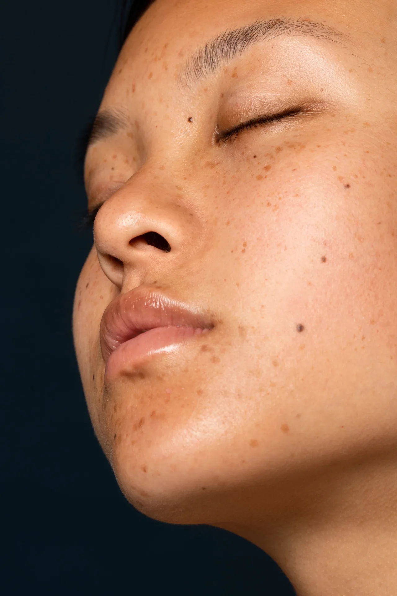 Brown Spots vs. Sun Spots: What’s the Difference and How to Treat Them?