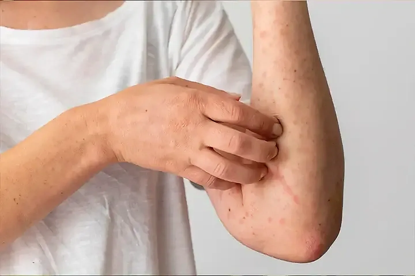 What Are The Symptoms?