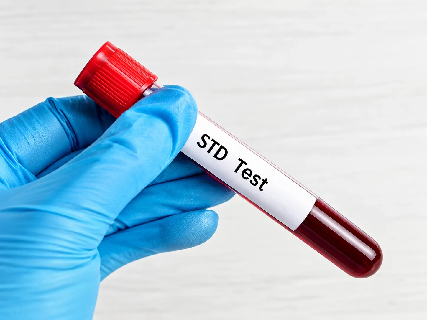 STD Screening in Dubai