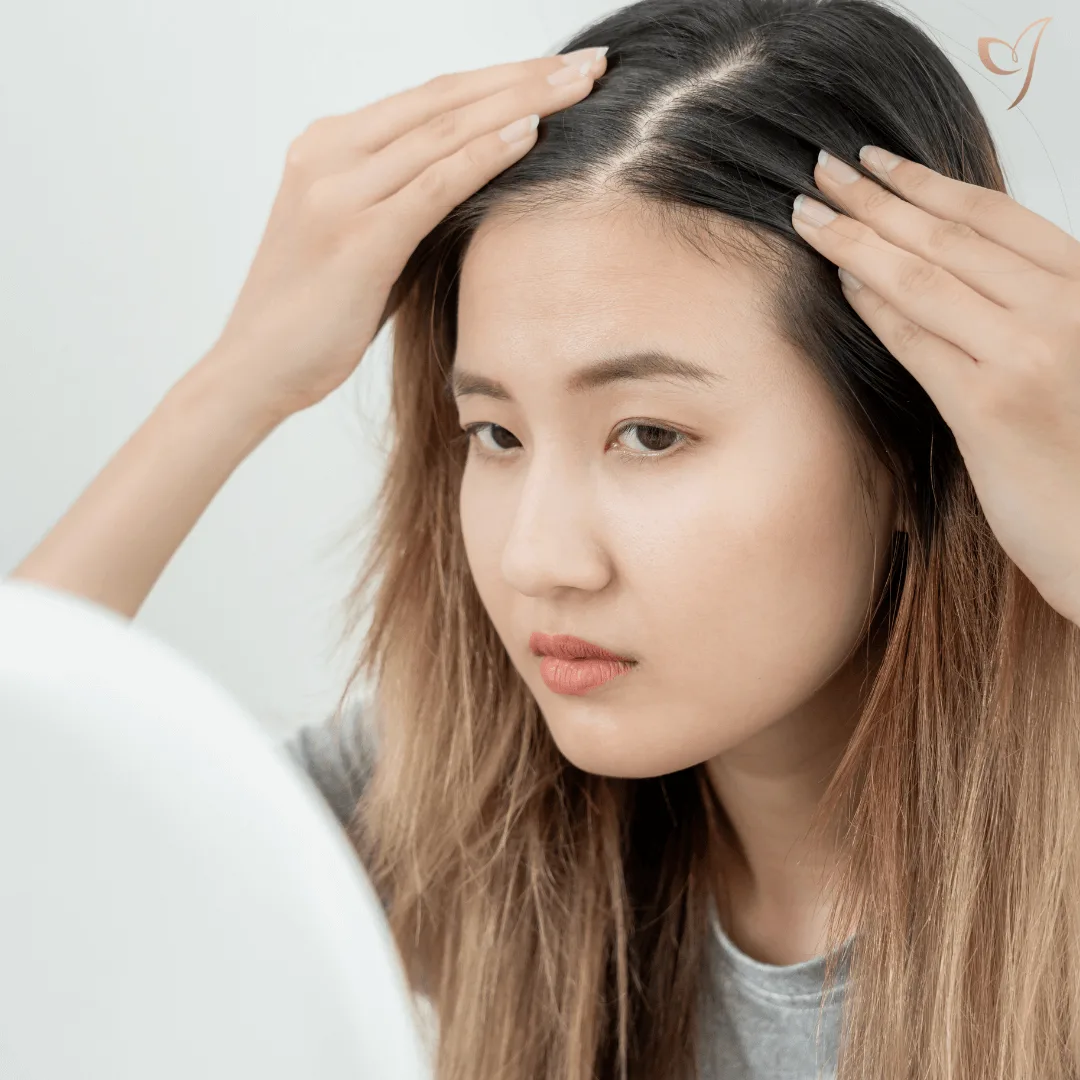 Revolutionizing Hair Loss Treatment with Exosomes