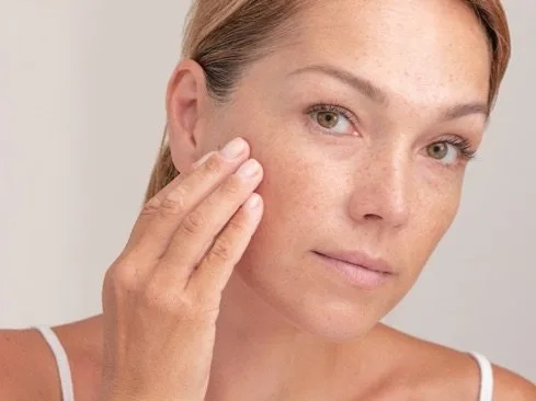 Sunspots Treatment in Dubai